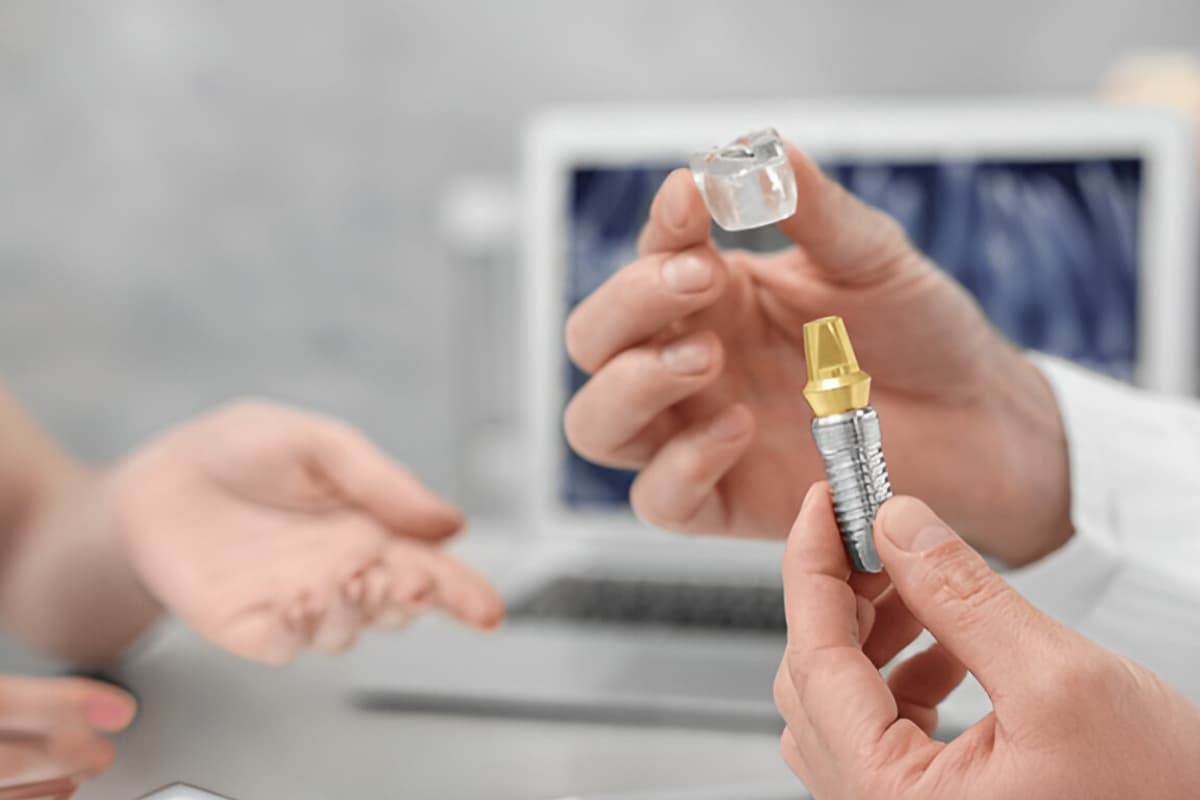 Guided surgery for dental implants in Albania using surgical stent.