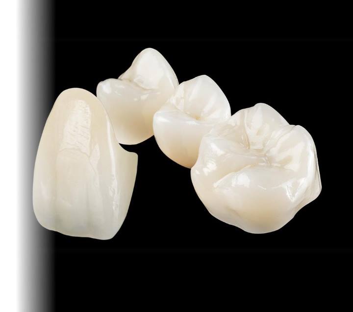 Scopri le differenze tra corone E-max e zirconia per i denti anteriori. Guida completa su estetica, resistenza, durata e costi. Consigli degli esperti di Medaljon Dent.