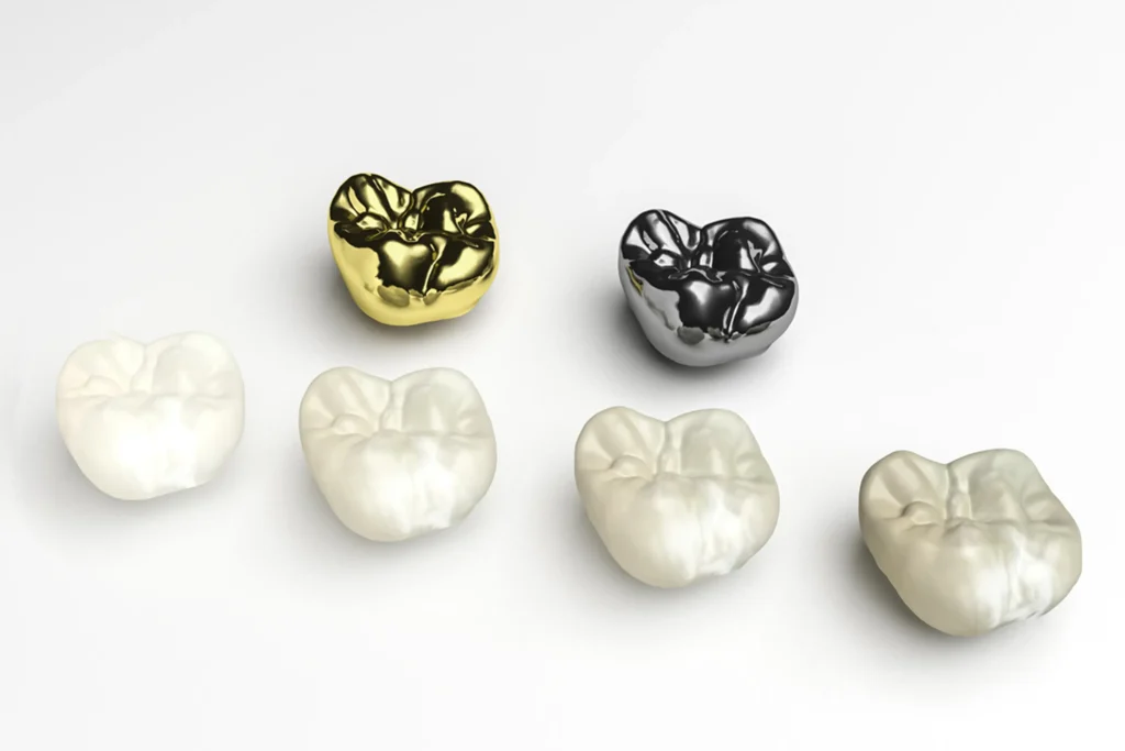 Looking for the best materials for dental crowns in Albania? Discover the pros, cons, and costs of zirconia, E-max, and porcelain crowns, and learn how to choose the right one for your smile.